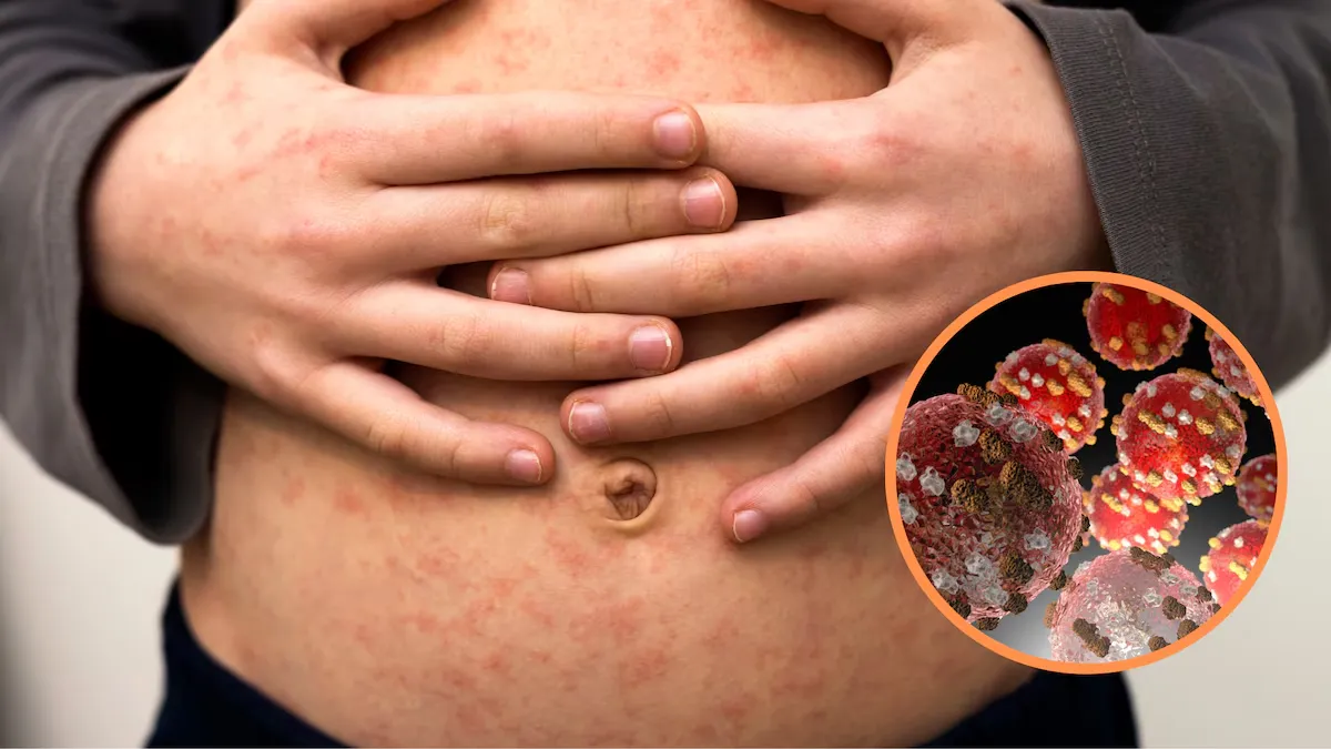 imagen_2025-03-21_134208682